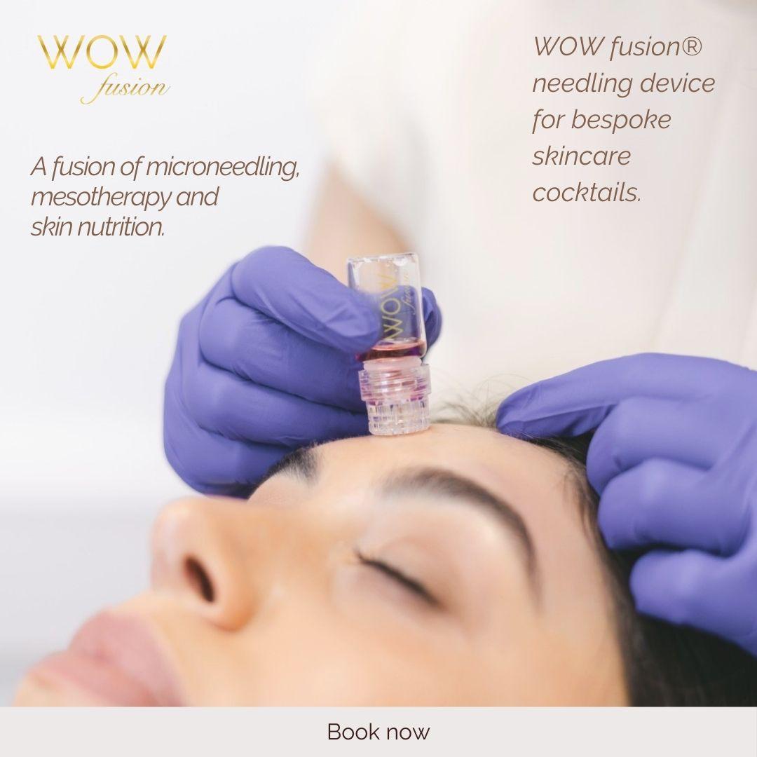 WOW Fusion needling device being used during a facial treatment